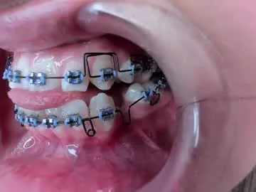 miss___salome — She just turned 18. Cute,barely legal,with pigtails, a slutty teen loves double anal penetration and cum. - Goal is : Recolect Spit in Bowl and cover all FACE #deepthroat #saliva #atm #ahegao #braces